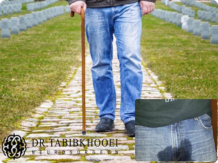 علائم هشدار در بیمار مبتلا به بیرونزدگی دیسک کمر
