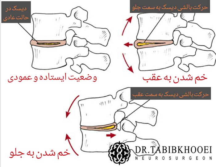 عملکرد بالشی دیسکها
