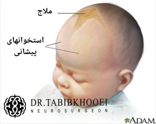علائم تومورهای مغزی در کودکان | دکتر علیرضا طبیب خوئی|جراح مغز و اعصاب ...