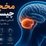 مخچه