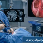 جراحی کرانیوفارنژیوما