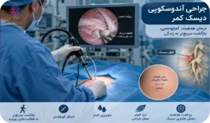 جراحی دیسک کمر به روش آندوسکوپی
