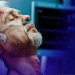 آیا خونریزی مغزی منجر به مرگ میشود ؟